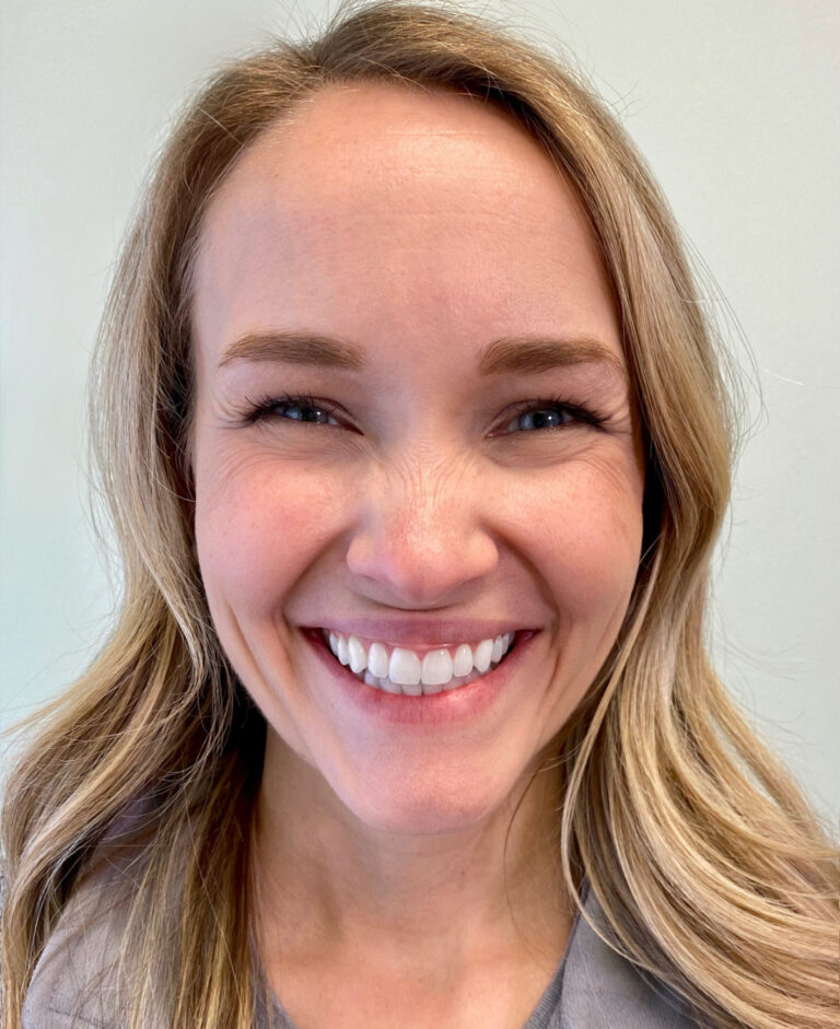 Example smile photo angle 1 for a virtual consultation